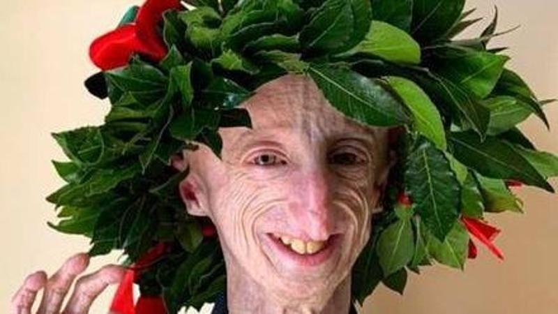 Poche lacrime, tanti sorrisi e un profondo omaggio alla vita vissuta intensamente. Così si sono svolti i funerali di Sammy Basso, il biologo vicentino affetto da progeria, scomparso a soli 28 anni. Un momento che ha unito 3-4mila persone a Tezze sul Brenta per celebrare non solo un addio, ma una festa, come da lui voluto.