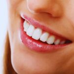 come avere denti bianchissimi