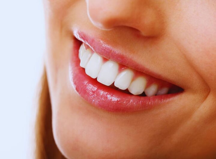 come avere denti bianchissimi