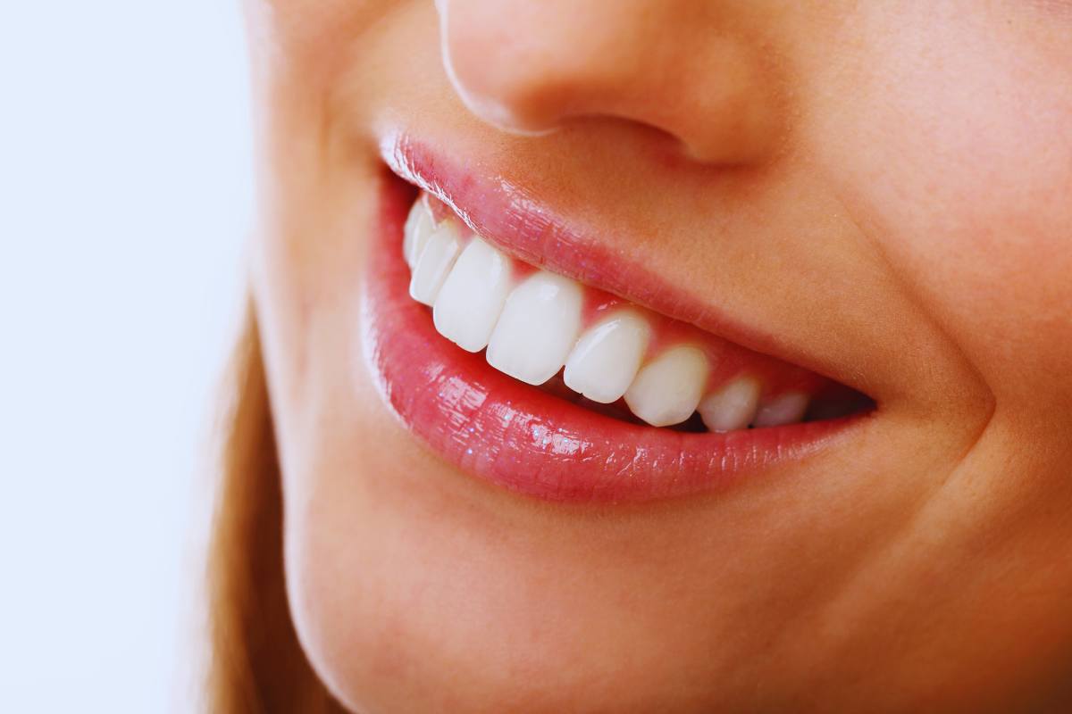 come avere denti bianchissimi